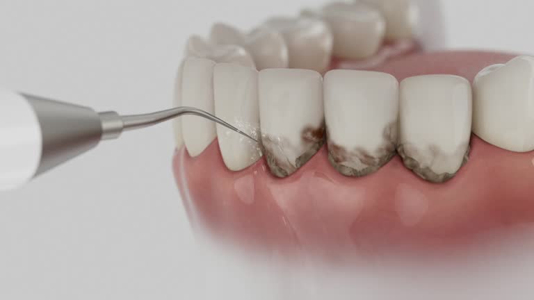 Reliable Tooth Extraction contractor in Mount Airy, NC by Smile Center Dentistry